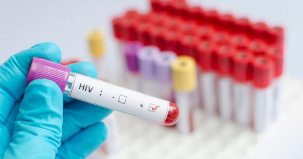 Celulas-asesinas-ayudarian-a-eliminar-el-VIH